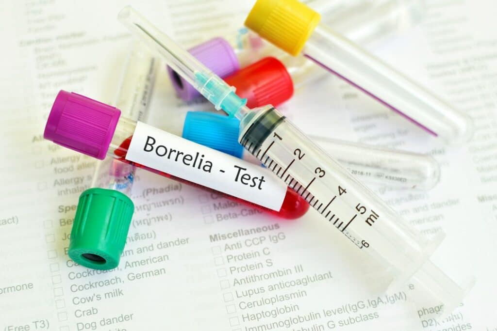 test na borelioze