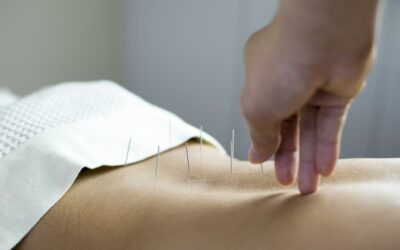 Skąd wywodzi się akupunktura?